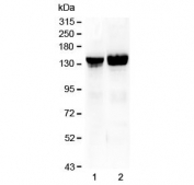 Western blot testing of 1) rat liver and 2) mouse liver lysate with Collagen II antibody at 0.5ug/ml. Predicted molecular weight ~140 kDa.