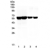 Western blot testing of different lots of mouse testis lysate (lanes 1, 2) and rat testis lysate (lanes 3, 4) with Cyp17a1 antibody at 0.5ug/ml. Predicted molecular weight ~57 kDa.