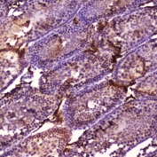 IHC testing of FFPE rat testis tissue with Cyp17a1 antibody at 2ug/ml. HIER: boil tissue sections in pH6, 10mM citrate buffer, for 10-20 min followed by cooling at RT for 20 min.