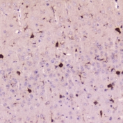 IHC testing of FFPE mouse brain tissue with Cystatin C antibody at 2ug/ml. HIER: boil tissue sections in pH6, 10mM citrate buffer, for 10-20 min followed by cooling at RT for 20 min.