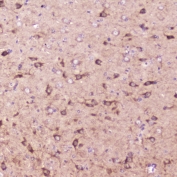 IHC testing of FFPE mouse brain tissue with IGFBP2 antibody at 2ug/ml. HIER: boil tissue sections in pH6, 10mM citrate buffer, for 10-20 min followed by cooling at RT for 20 min.