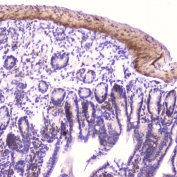 IHC testing of FFPE mouse small intestine tissue with IGFBP2 antibody at 2ug/ml. HIER: boil tissue sections in pH6, 10mM citrate buffer, for 10-20 min followed by cooling at RT for 20 min.