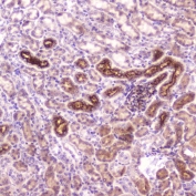 IHC testing of FFPE mouse kidney tissue with IGFBP2 antibody at 2ug/ml. HIER: boil tissue sections in pH6, 10mM citrate buffer, for 10-20 min followed by cooling at RT for 20 min.