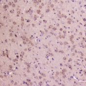 IHC testing of FFPE rat brain tissue with IGFBP2 antibody at 2ug/ml. HIER: boil tissue sections in pH6, 10mM citrate buffer, for 10-20 min followed by cooling at RT for 20 min.