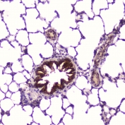 IHC testing of FFPE rat lung tissue with IGFBP2 antibody at 2ug/ml. HIER: boil tissue sections in pH6, 10mM citrate buffer, for 10-20 min followed by cooling at RT for 20 min.