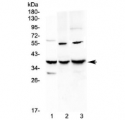Western blot testing of 1) rat liver, 2) mouse Neuro-2a and 3) mouse HEPA1-6 lysate with IGFBP2 antibody at 0.5ug/ml. Predicted molecular weight ~35 kDa, observed here at ~40 kDa.