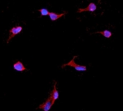 Immunofluorescent staining of FFPE rat NRK cells with IGFBP2 antibody (red) and DAPI nuclear stain (blue). HIER: steam section in pH6 citrate buffer for 20 min.