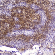 IHC testing of FFPE human tonsil tissue with FABP3 antibody at 2ug/ml. HIER: boil tissue sections in pH6, 10mM citrate buffer, for 10-20 min followed by cooling at RT for 20 min.