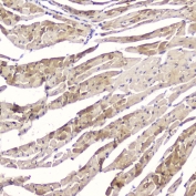 IHC testing of FFPE mouse heart tissue with FABP3 antibody at 2ug/ml. HIER: boil tissue sections in pH6, 10mM citrate buffer, for 10-20 min followed by cooling at RT for 20 min.