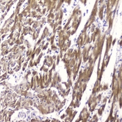 IHC testing of FFPE rat heart tissue with FABP3 antibody at 2ug/ml. HIER: boil tissue sections in pH6, 10mM citrate buffer, for 10-20 min followed by cooling at RT for 20 min.