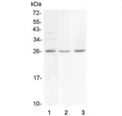 Western blot testing of 1) human COLO-320, 2) rat brain and 3) mouse brain lysate with FGF9 antibody at 0.5ug/ml. Predicted molecular weight ~23 kDa with a possible 45-55 kDa dimer.