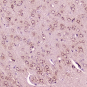 IHC testing of FFPE rat brain with Calcitonin antibody at 2ug/ml. HIER: steamed antigen retrieval with pH6 citrate buffer.