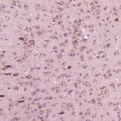 IHC testing of FFPE mouse brain with Calcitonin antibody at 2ug/ml. HIER: steamed antigen retrieval with pH6 citrate buffer.