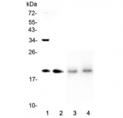 Western blot testing of 1) human HeLa, 2) human placenta, 3) rat lung and 4) mouse lung lysate with Dermatopontin antibody at 0.5ug/ml. Expected molecular weight ~22 kDa.