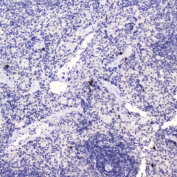 IHC testing of FFPE rat spleen tissue with HE4 antibody at 0.5ug/ml. HIER: boil tissue sections in pH6, 10mM citrate buffer, for 10-20 min followed by cooling at RT for 20 min.