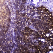 IHC testing of FFPE human tonsil tissue with Talin 1 antibody at 2ug/ml. HIER: boil tissue sections in pH6, 10mM citrate buffer, for 10-20 min followed by cooling at RT for 20 min.