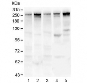 Western blot testing of 1) rat lung, 2) mouse lung, 3) human U-87 MG, 4) human MDA-MB-231 and 5) human HepG2 lysate with Talin 1 antibody. Predicted molecular weight ~275 kDa.