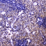 IHC testing of FFPE mouse spleen with Talin 1 antibody at 2ug/ml. HIER: boil tissue sections in pH6, 10mM citrate buffer, for 10-20 min followed by cooling at RT for 20 min.