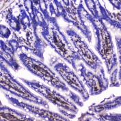 IHC testing of FFPE mouse small intestine with Talin 1 antibody at 2ug/ml. HIER: boil tissue sections in pH6, 10mM citrate buffer, for 10-20 min followed by cooling at RT for 20 min.