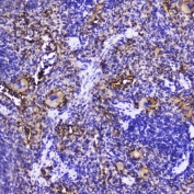 IHC testing of FFPE rat spleen with Talin 1 antibody at 2ug/ml. HIER: boil tissue sections in pH6, 10mM citrate buffer, for 10-20 min followed by cooling at RT for 20 min.