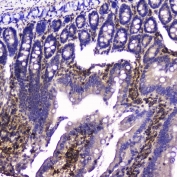 IHC testing of FFPE rat small intestine with Talin 1 antibody at 2ug/ml. HIER: boil tissue sections in pH6, 10mM citrate buffer, for 10-20 min followed by cooling at RT for 20 min.