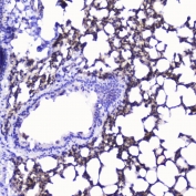 IHC testing of FFPE rat lung with Talin 1 antibody at 2ug/ml. HIER: boil tissue sections in pH6, 10mM citrate buffer, for 10-20 min followed by cooling at RT for 20 min.