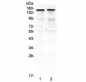 Western blot testing of 1) rat brain and 2) mouse brain lysate with THBS2 antibody at 0.5ug/ml. Expected molecular weight: 130-170 kDa depending on glycosylation level.