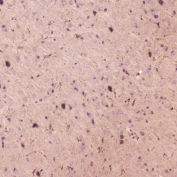 IHC testing of FFPE mouse brain with SPARCL1 antibody at 2ug/ml. HIER: boil tissue sections in pH6, 10mM citrate buffer, for 10-20 min followed by cooling at RT for 20 min.