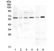Western blot testing of human 1) U-87 MG, 2) SHG-44, 3) MDA-MB-231, 4) K562, 5) rat C6 and 6) mouse smooth muscle (intestine) lysate. Predicted molecular weight ~75 kDa, observed here at ~62 kDa.