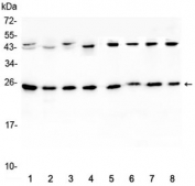 Western blot testing of 1) rat brain, 2) rat lung, 3) mouse brain, 4) mouse lung and human 5) HeLa, 6) placenta, 7) MCF7 and 8) HepG2 lystate with IL36A antibody at 0.5ug/ml. Predicted molecular weight ~17 kDa, routinely observed at 18-22 kDa.