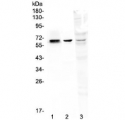 Western blot testing of 1) rat kidney, 2) mouse kidney and 3) human MDA-MB-231 lysate with COBRA1 antibody at 0.5ug/ml. Predicted molecular weight ~66 kDa.