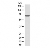 Western blot testing of human A431 cell lysate with Beta 2 Adrenergic Receptor antibody at 0.5ug/ml. Predicted molecular weight ~46 kDa, but commonly observed at up to 85 kDa.