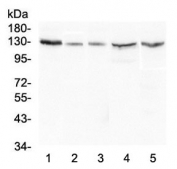 Western blot testing of human 1) HeLa, 2) A549, 3) 22RV1, 4) HepG2 and 5) Caco-2 lysate with CASR antibody at 0.5ug/ml. Predicted molecular weight ~121 kDa, but is routinely observed at up to ~160 kDa.