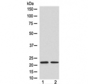 Western blot testing of 1) human HeLa and 2) mouse spleen lysate with FGF21 antibody at 0.5ug/ml. Predicted molecular weight ~21 kDa.