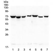 Western blot testing of human 1) HeLa, 2) COLO-320, 3) SW620, 4) A431, 5) A549, 6) HepG2 and 7) PANC-1 lysate with HSP70 antibody at 0.5ug/ml. Expected molecular weight ~70 kDa.