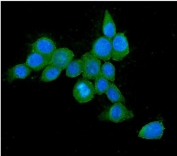 Immunofluorescent staining of FFPE human MCF7 cells with HSP70 antibody (green) and DAPI nuclear stain (blue). HIER: steam section in pH6 citrate buffer for 20 min.