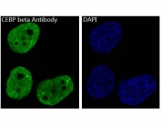 Immunofluorescent staining of FFPE human HeLa cells with CEBPB antibody (green) and DAPI nuclear stain (blue). HIER: steam section in pH6 citrate buffer for 20 min.