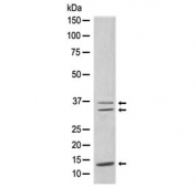 Western blot testing of human MCF7 cell lysate with CEBPB antibody. Expected molecular weight: 36-41 kDa and ~16 kDa (LIP isoform).