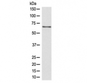 Western blot testing of human Jurkat lysate with CDC45 antibody at 0.5ug/ml. Predicted molecular weight ~66 kDa.