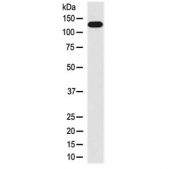 Western blot testing of human HUVEC cell lysate with MLCK antibody at 0.5ug/ml. Predicted molecular weight: isoforms from 197-211 kDa and ~110 kDa, observed here at ~140 kDa.