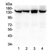 Western blot testing of human 1) HeLa, 2) A549, 3) MCF7 and 4) MDA-MB-453 lysate with SMC3 antibody at 0.5ug/ml. Predicted molecular weight ~141 kDa.