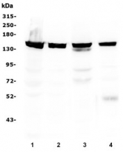 Western blot testing of 1) human HeLa, 2) human HEK293, 3) rat thymus and 4) mouse thymus lysate with SMC3 antibody at 0.5ug/ml. Predicted molecular weight ~141 kDa.