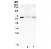 Western blot testing of human 1) A375, 2) A549 and 3) SMMC-7721 lysate with ARSA antibdoy at 0.5ug/ml. Expected molecular weight: 53-63 kDa.