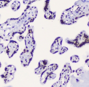 IHC testing of FFPE human placenta with RbAp48 antibody. HIER: boil tissue sections in pH6, 10mM citrate buffer, for 10-20 min followed by cooling at RT for 20 min.