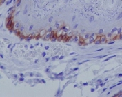 IHC testing of FFPE mouse skin with Collagen XVII antibody at 2ug/ml. HIER: boil tissue sections in pH6, 10mM citrate buffer, for 10-20 min followed by cooling at RT for 20 min.