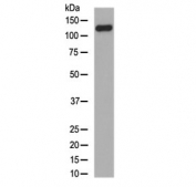 Western blot testing of human skin lysate with Collagen XVII antibody at 0.5ug/ml. Expected molecular weight ~120 kDa and ~180 kDa.