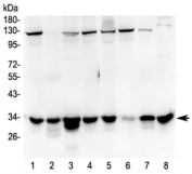 Western blot testing of human 1) HeLa, 2) placenta, 3) 293T, 4) A549, 5) A375, 6) A431, 7) U-2 OS and 8) K562 lysate with PRKAB2 antibody at 0.5ug/ml. Predicted molecular weight ~30 kDa.