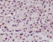 IHC testing of FFPE human pancreas with NeuN antibody at 2ug/ml. HIER: boil tissue sections in pH6, 10mM citrate buffer, for 10-20 min followed by cooling at RT for 20 min.