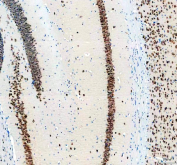 IHC staining of FFPE mouse brain tissue with NeuN antibody, HRP-secondary and DAB substrate. HIER: boil tissue sections in pH8 EDTA for 20 min and allow to cool before testing.