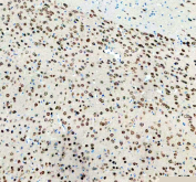 IHC staining of FFPE rat brain tissue with NeuN antibody, HRP-secondary and DAB substrate. HIER: boil tissue sections in pH8 EDTA for 20 min and allow to cool before testing.